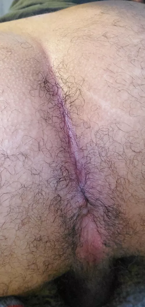 first time posting a hole pic is this hairy enough by Humble_Tiger_1519