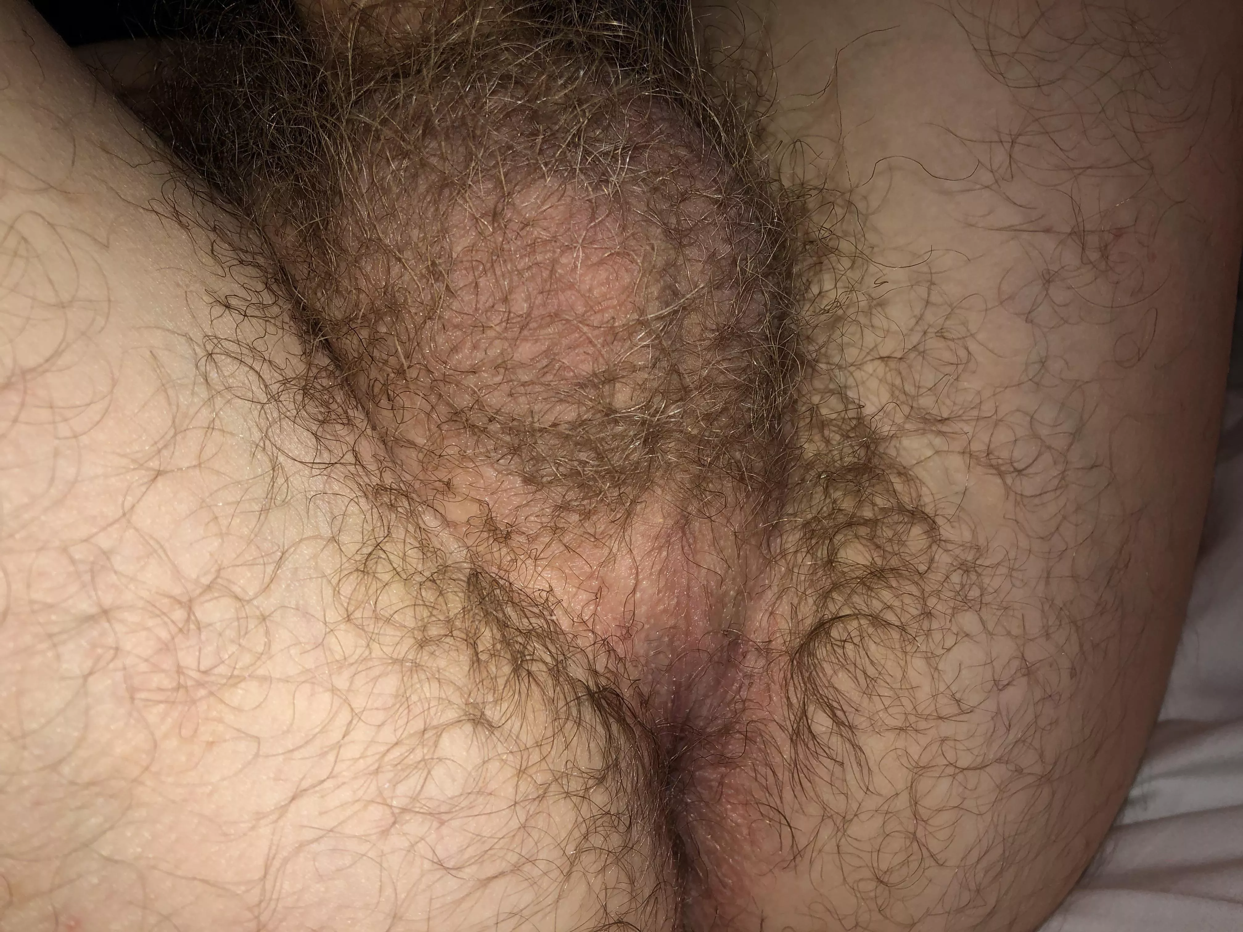 First time posting to this group posted by restoredforeskin