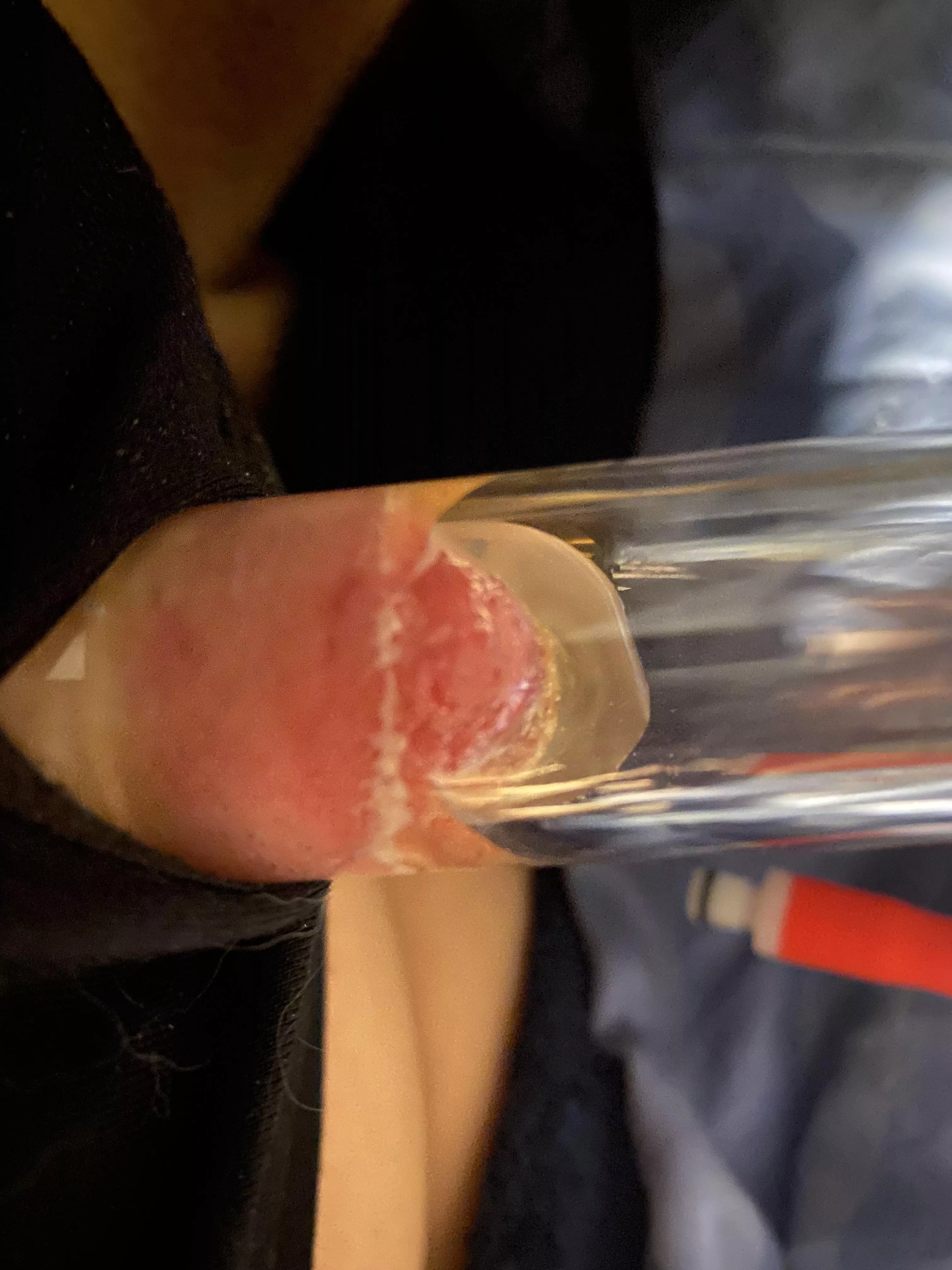 Fluid? Anyone have any info. Nipple pumping on AFAB. posted by Sheymazing