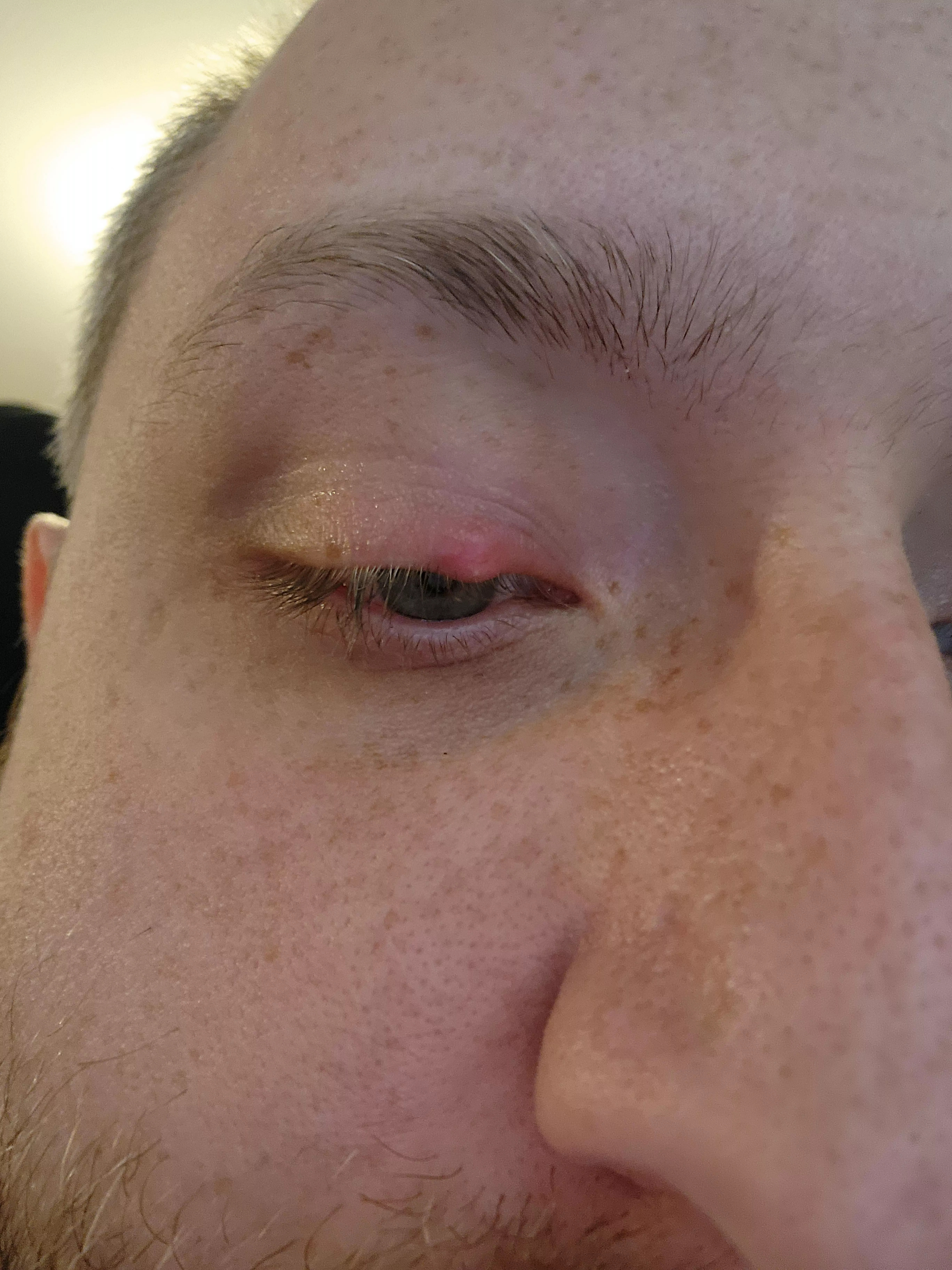 Forbidden Pop... Going on five days with this annoying lil guy posted by bfinleyui