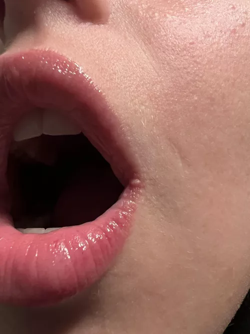 Forbidden pop in the corner of my mouth. Using every ounce of strength I have not to pop it by SmallKittyBigPurr