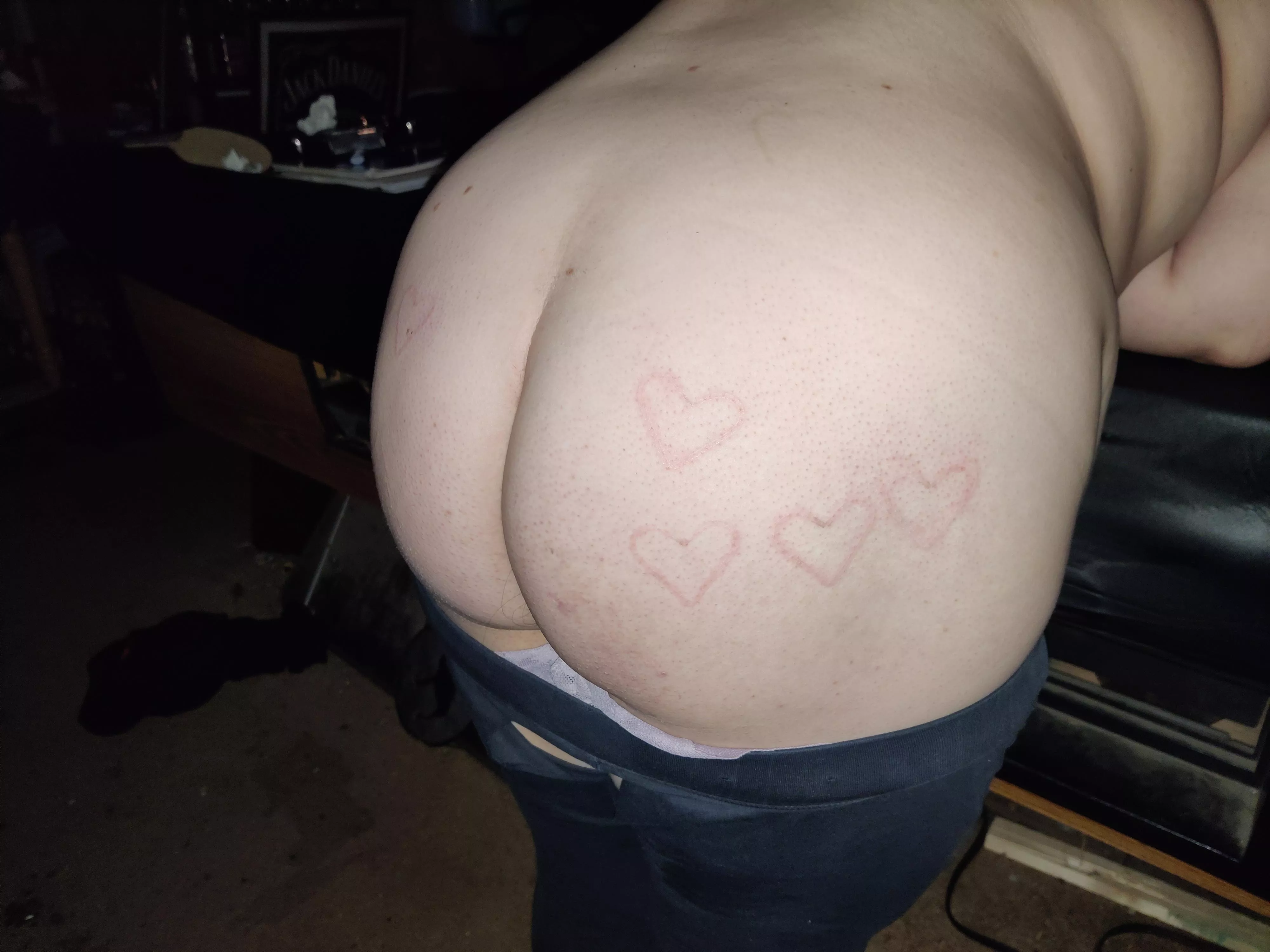 Foxo got some new burns for her special day posted by Open-Rooster1099