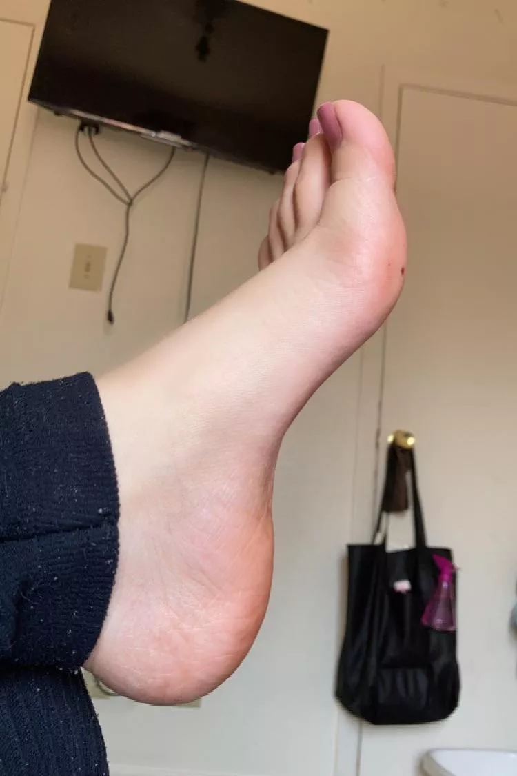 Freckle foot 🦶 posted by MICASATUNASA