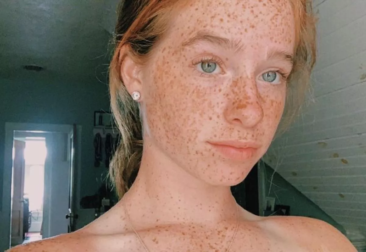 Freckled ginger posted by Weakness-Valuable