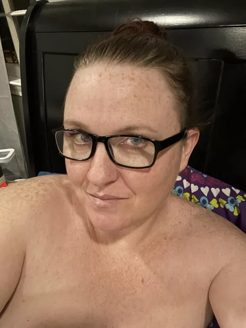 Freckles everywhere by swingingpeaches