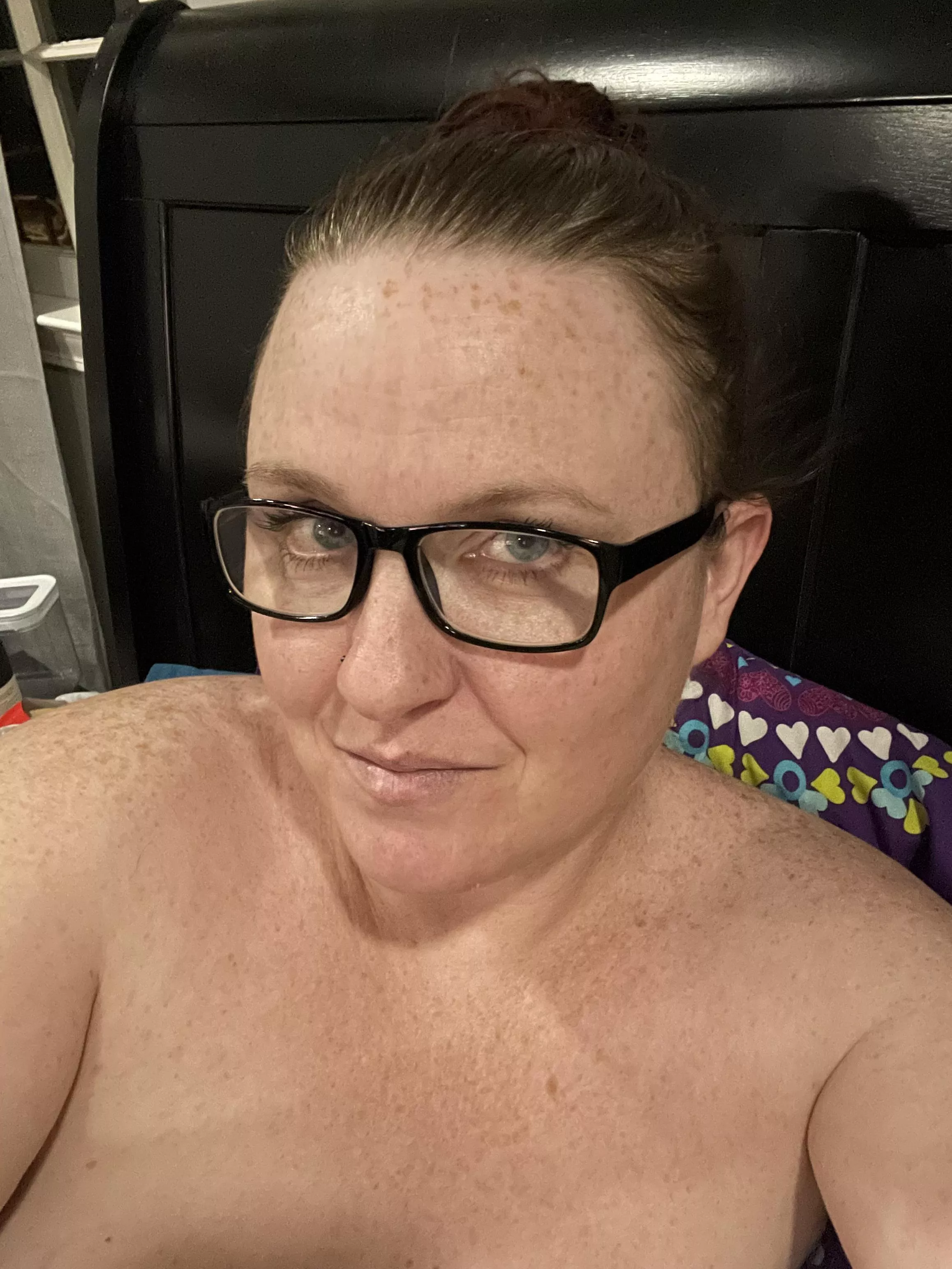 Freckles everywhere posted by swingingpeaches