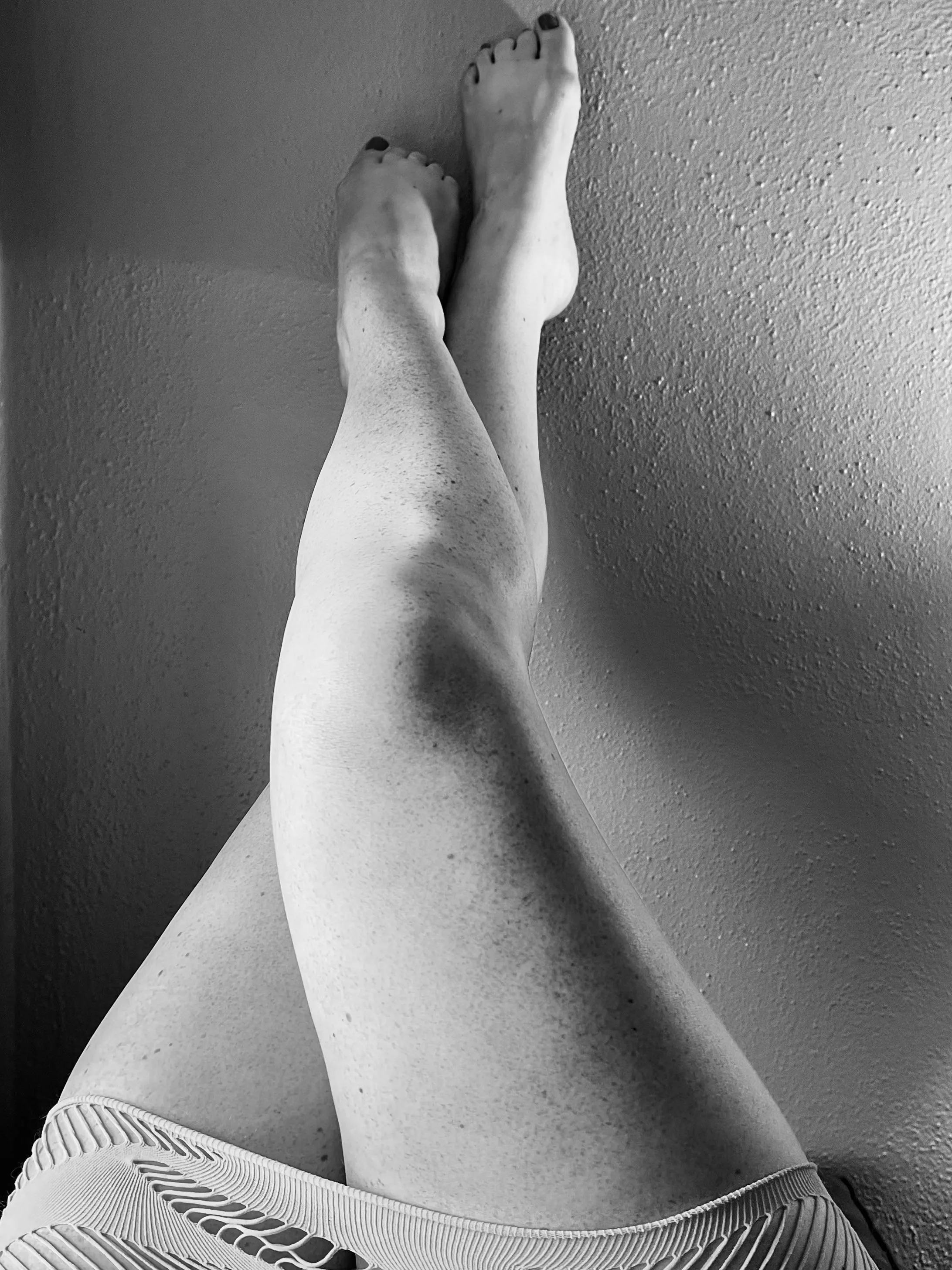 Freckles freckles everywhere! posted by CuriousJayne