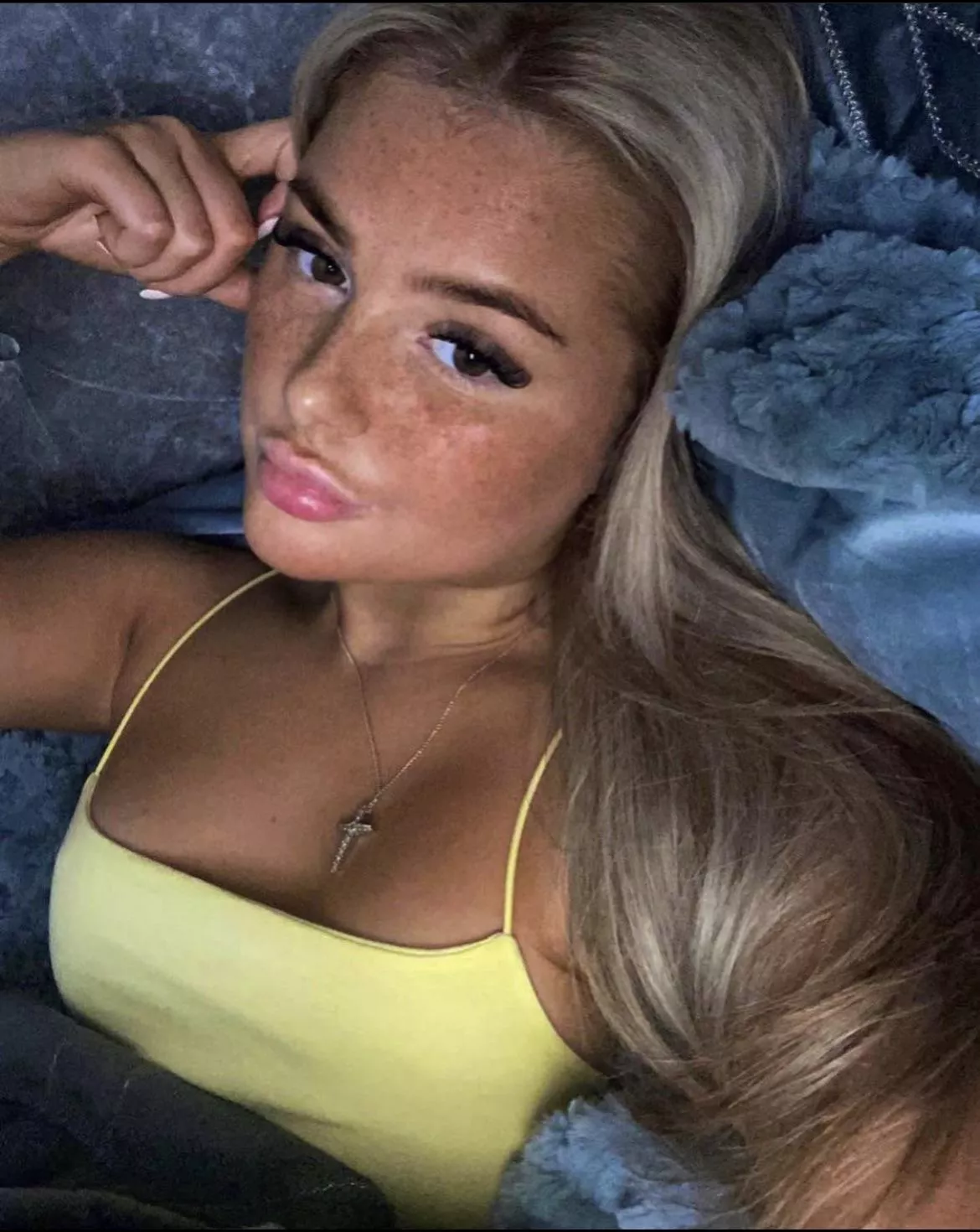 Freckles posted by Expert_Relation_2443