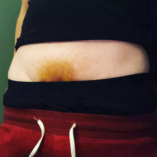 Frolic in my fire forest❤️‍🔥🌲 by Rude_Guess