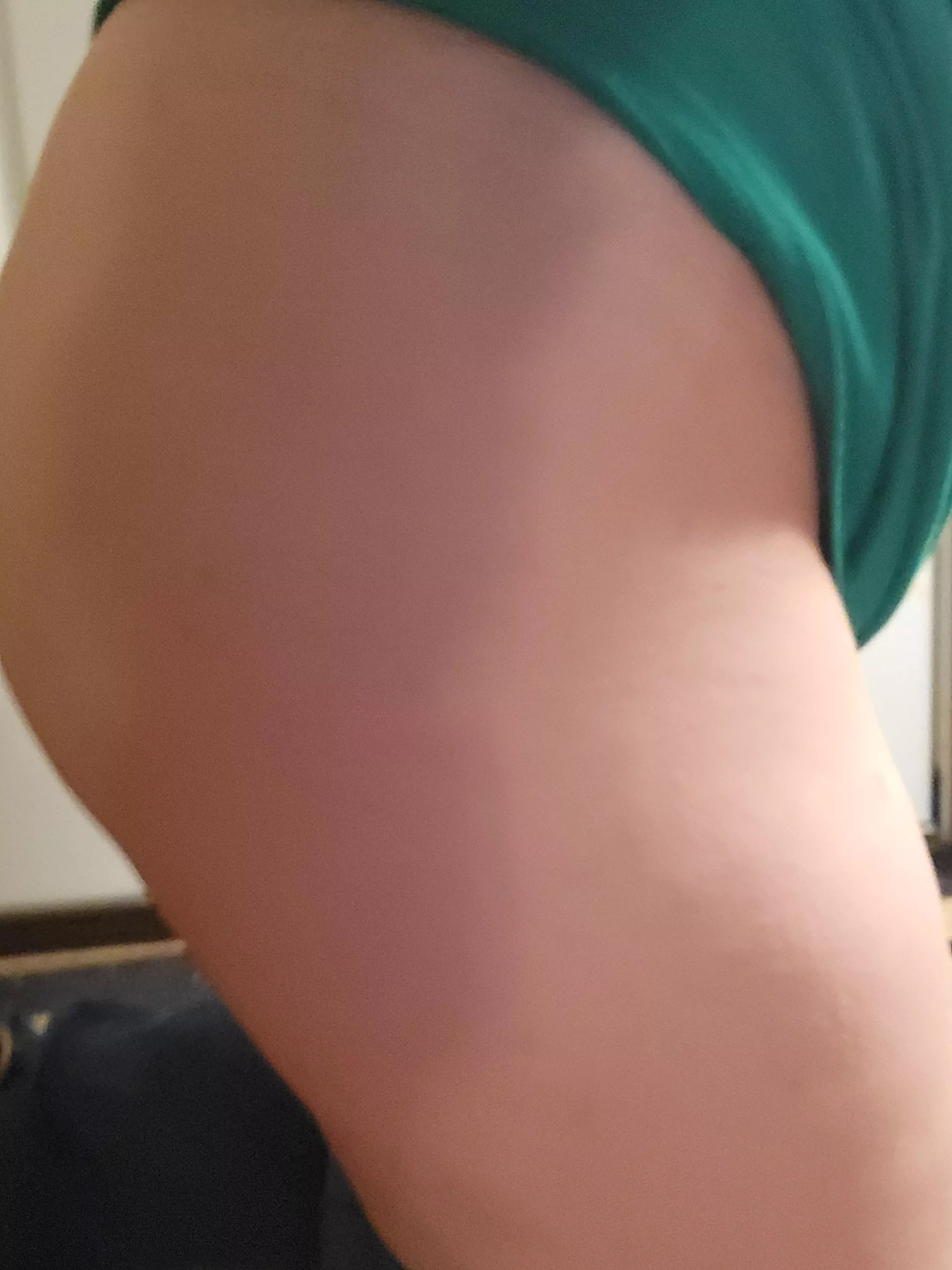 Full round hip with a bent thigh...I think this is it... posted by NaturalGround8418