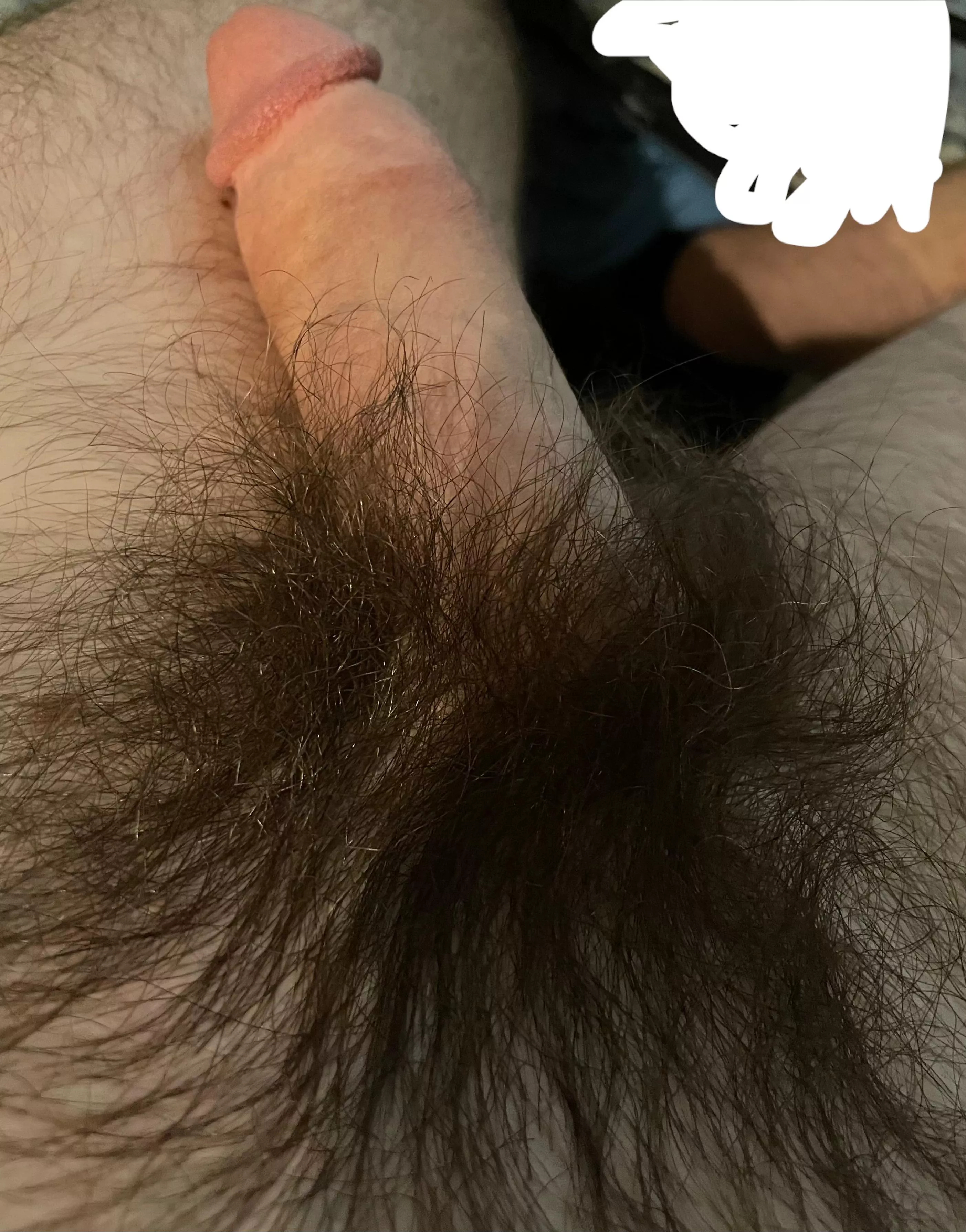 Gets so hairy if I don’t trim posted by New-Effort