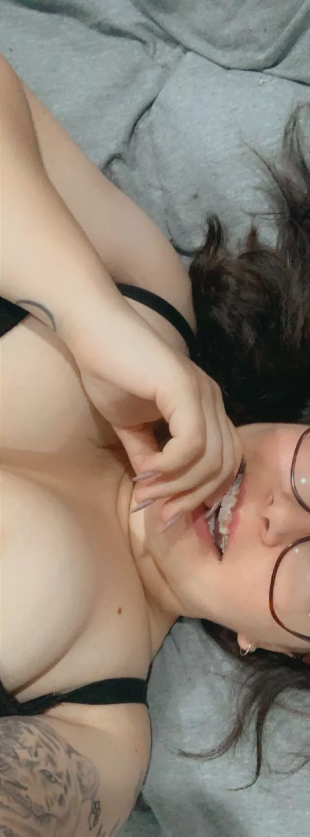 glasses AND braces 😅🙈 luckily the braces are coming off soon! posted by Lucys_littleSecret