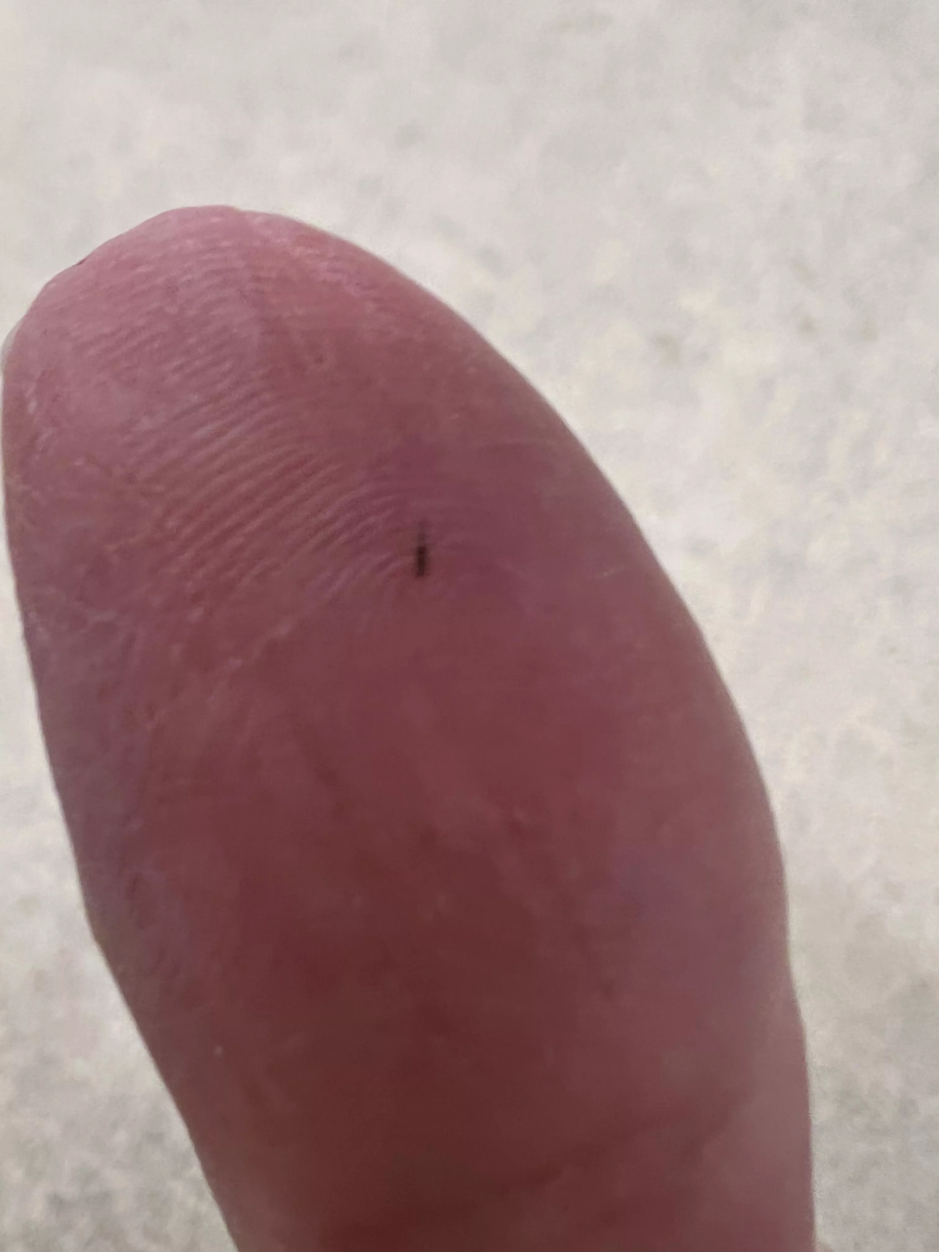 Got a sliver; no tweezers = torture! posted by SurvivingComplexPTSD
