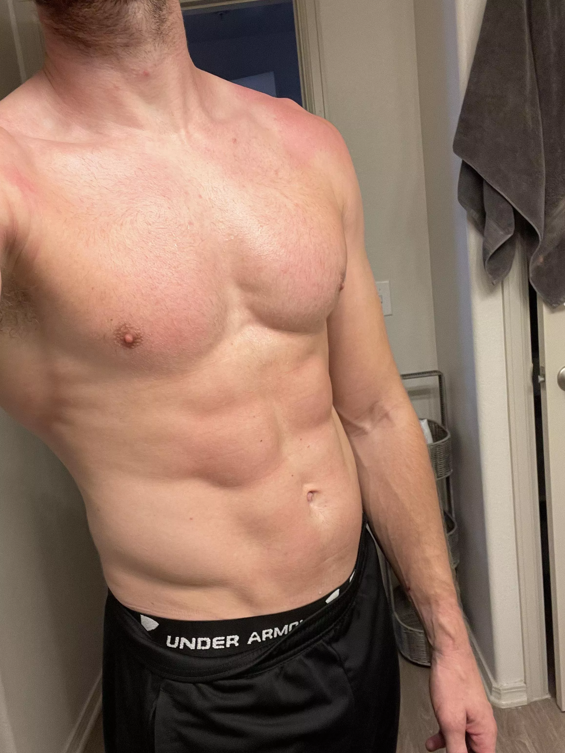 Got burnt.. who can rub [m]e with aloe? posted by MysteriousFun69