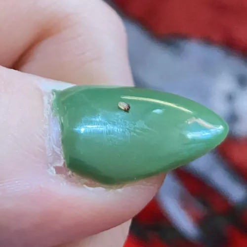 got this out of my back today! by ssl0th