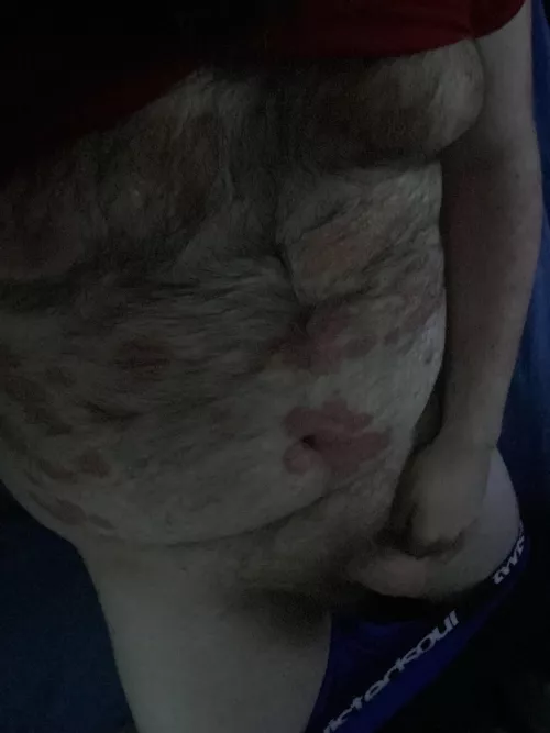 Got tired of having to hide it but I’m just gonna show off my true self, got some bad skin but I’m still hot af by Happybear-theday