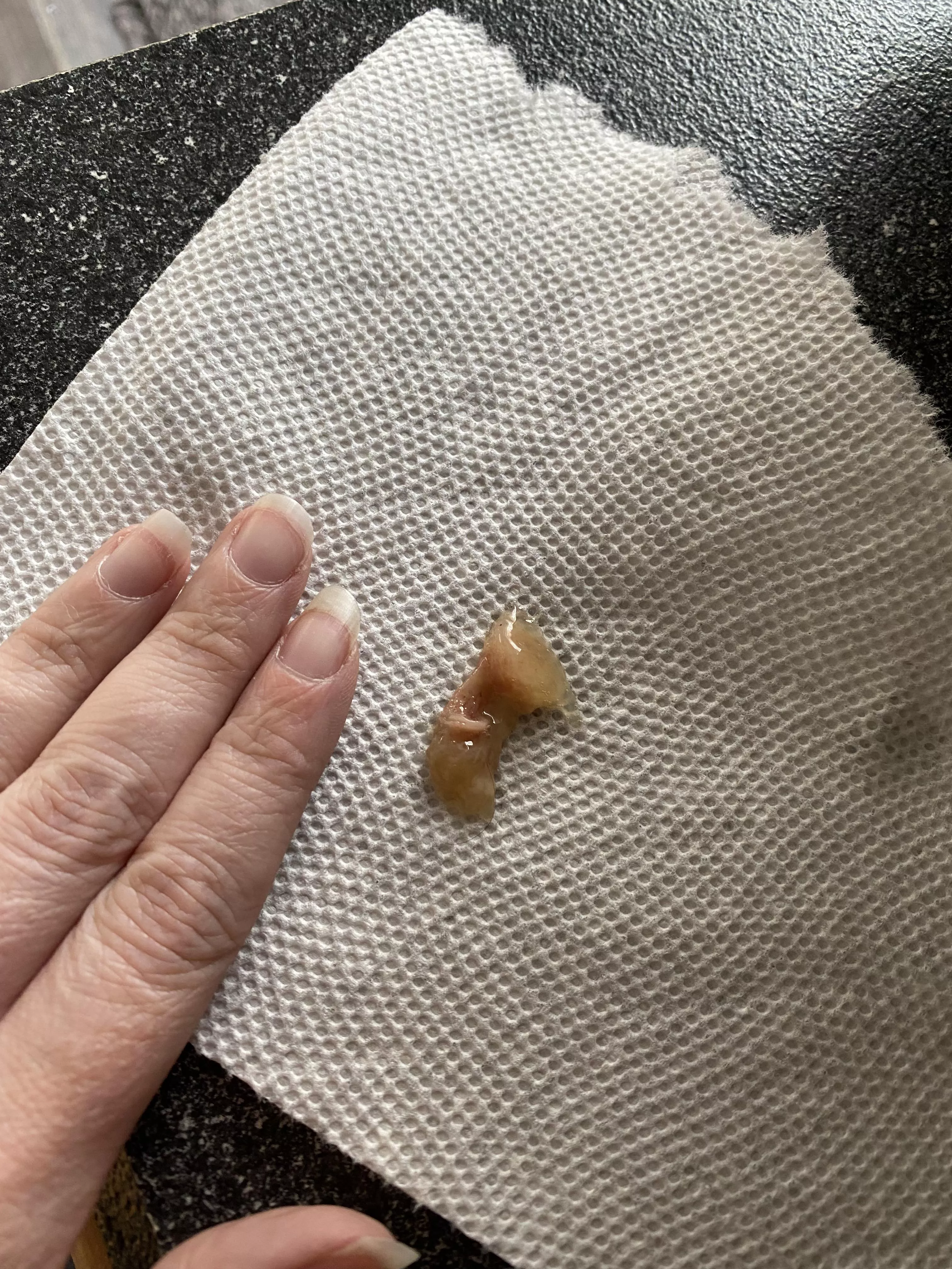 Guys…this came out of my sinuses and I feel like it was part of my brain. Am I gonna die 😂😂 posted by JustSomeBlondeBitch