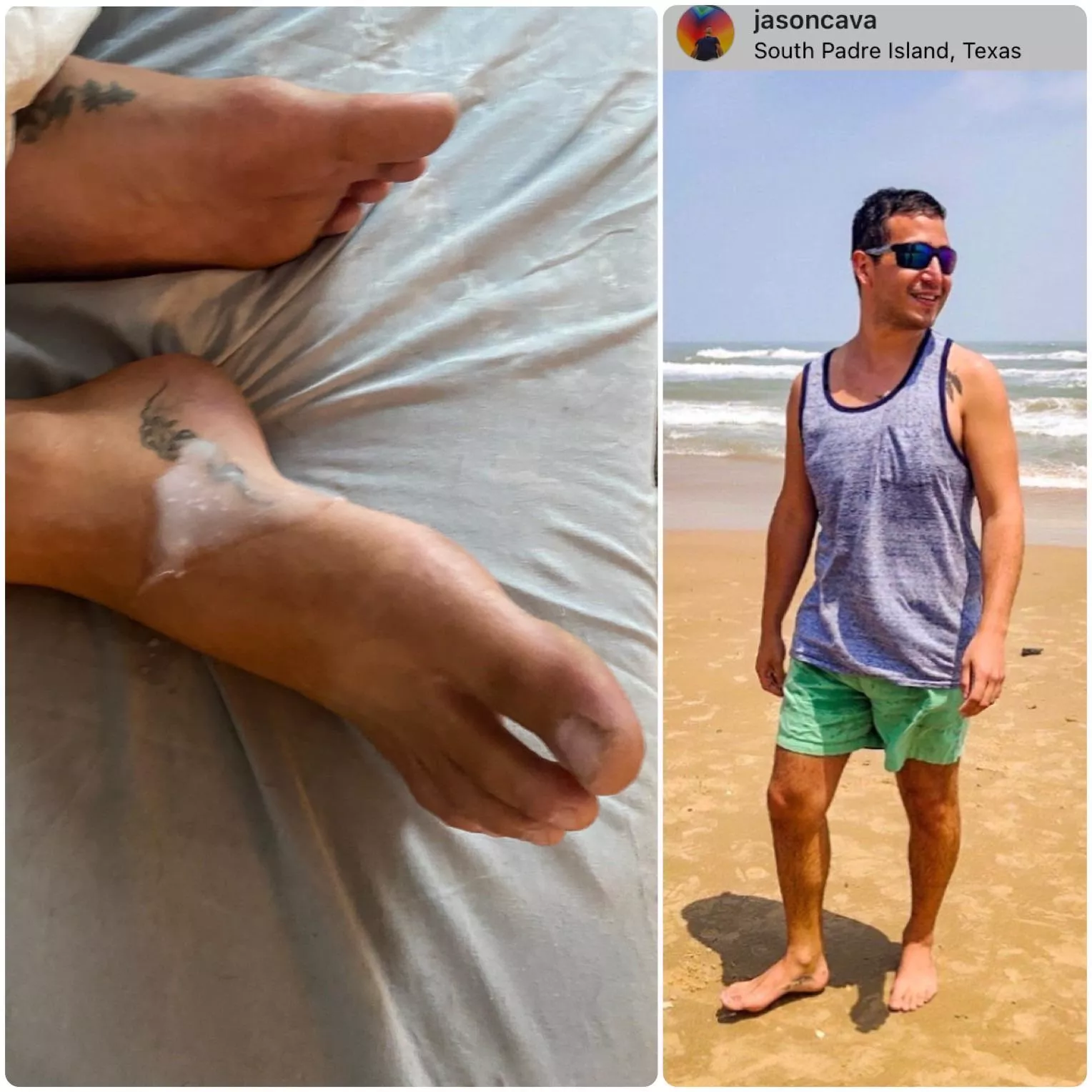 Had some fun with his sleeping feet 💦 posted by parzival4242