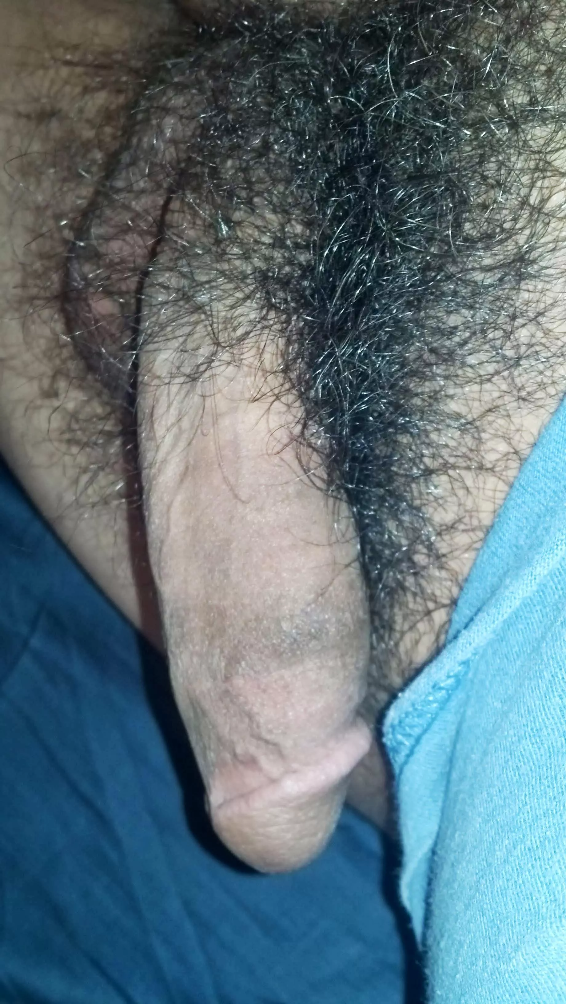 hairy 👀 posted by Tight-Surprise4831