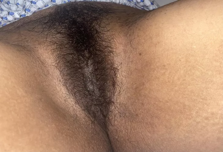 Hairy flash by redox30