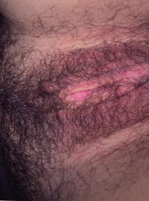 hairy with my pink clit poking out by ReputationOk59