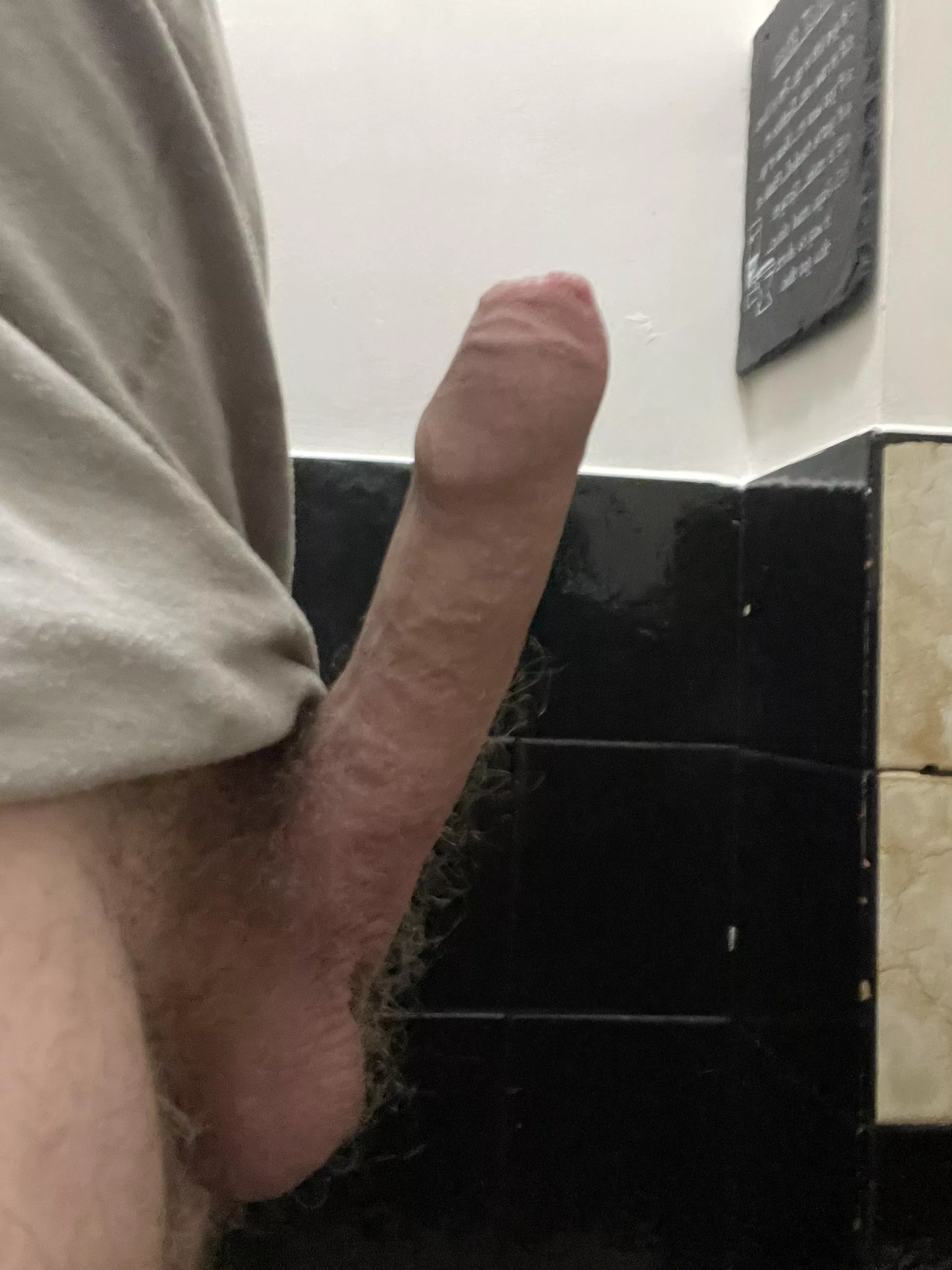 Hi, not sure if this is the right place, but want opinions, and to know who else’s penis goes up this far, issues, good bad? posted by iwasneverhere9902