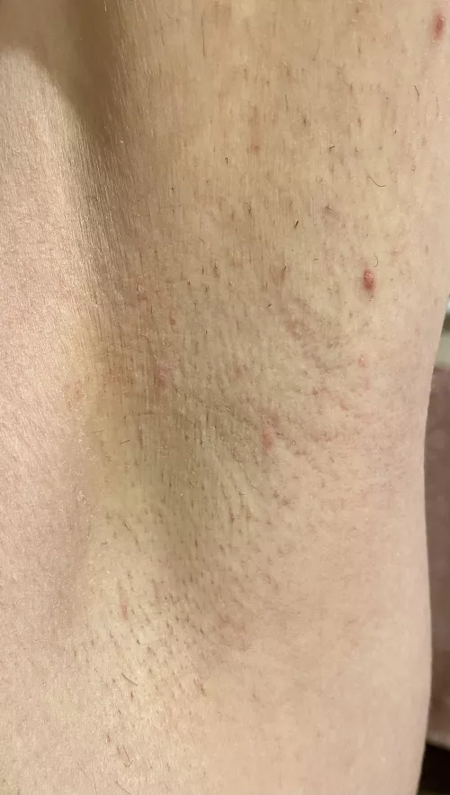 Hiya 😁 by sunnypits