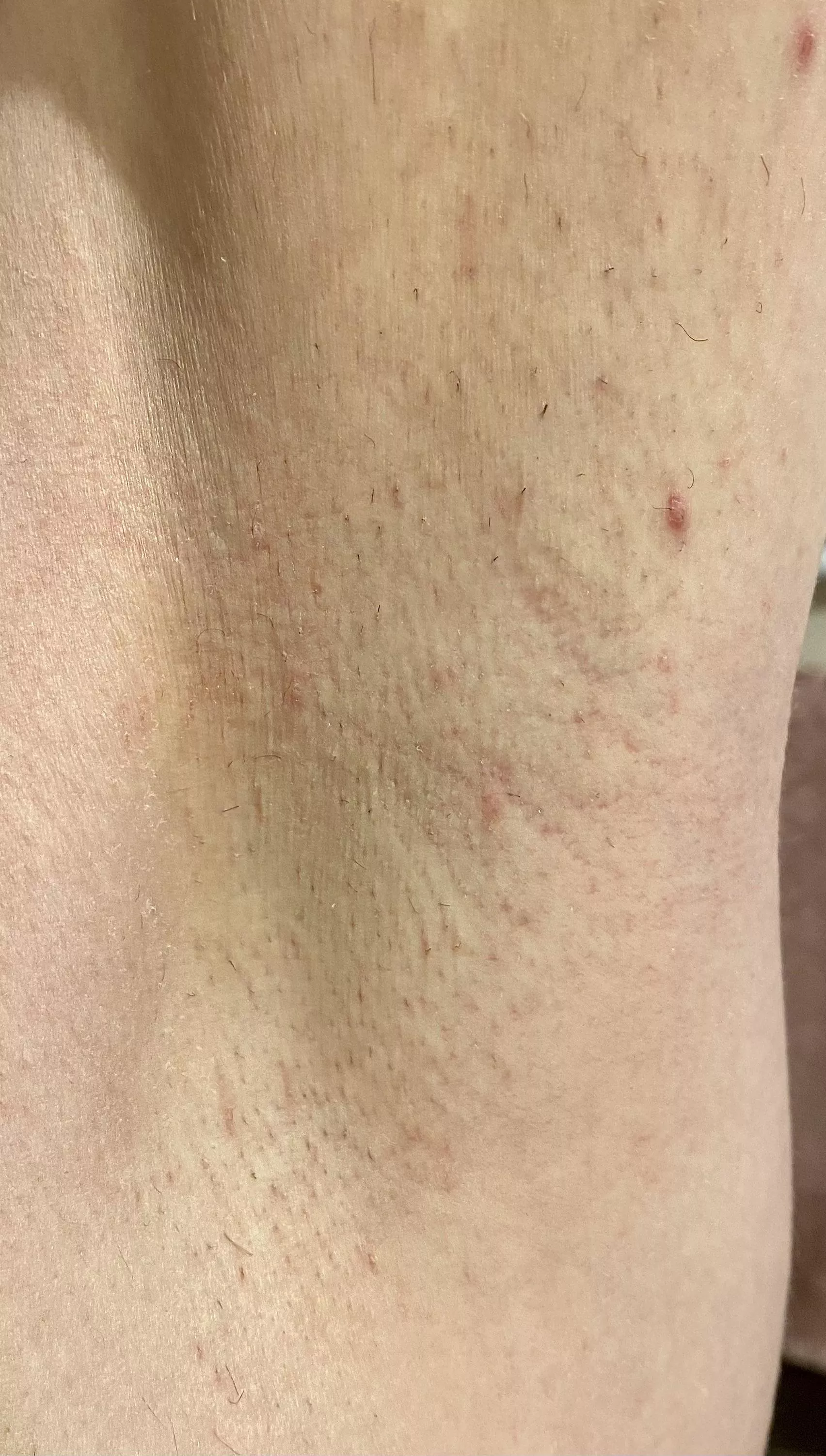 Hiya 😁 posted by sunnypits