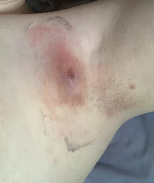 How its looking today by LoveCats47