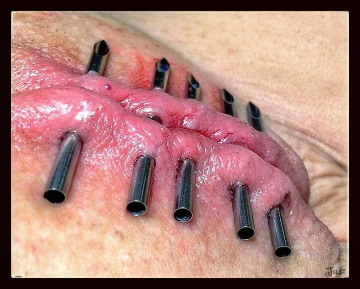 How to position piercings for locks correctly posted by theRoughMD