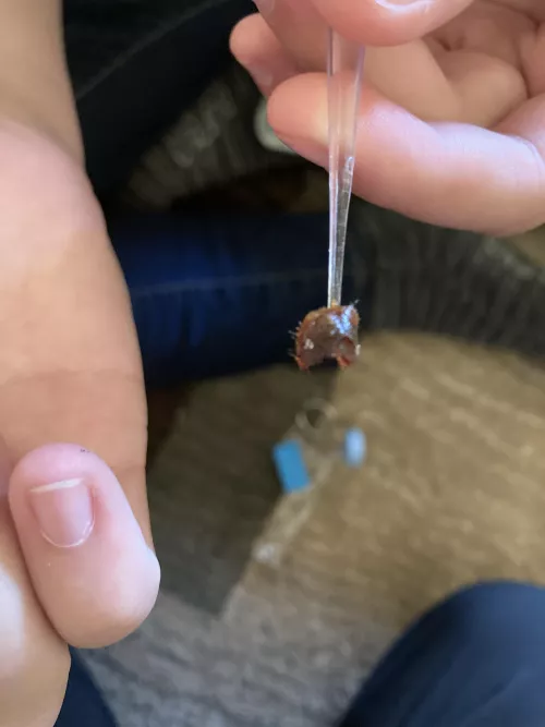 Husband pulled this out of my ear, pinky finger for size reference. by Juxtaposition19