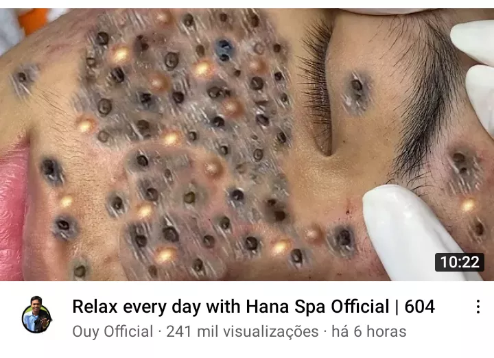 I am dumbfounded by this click bait posted by softfujoshi