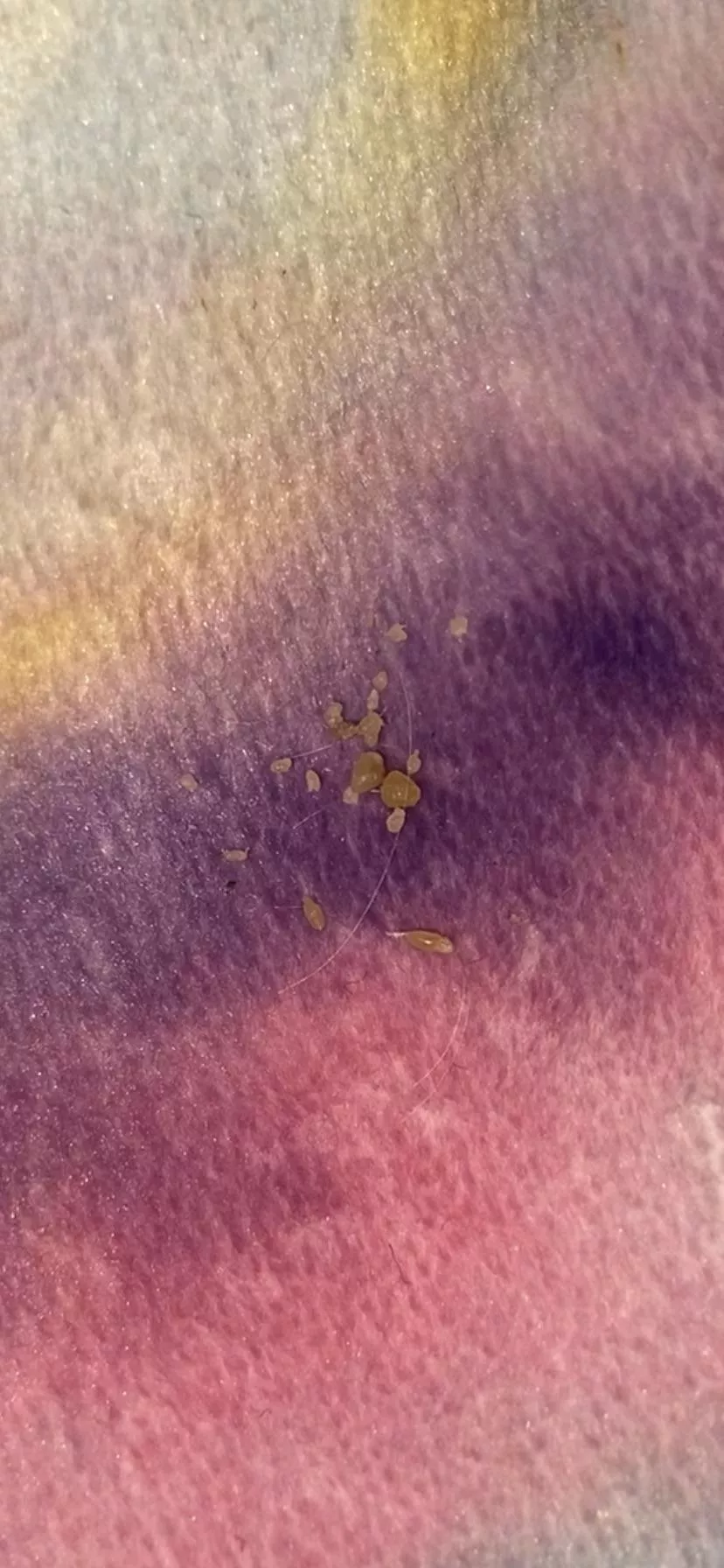 I call these ‘skin seeds’ posted by millyflowers