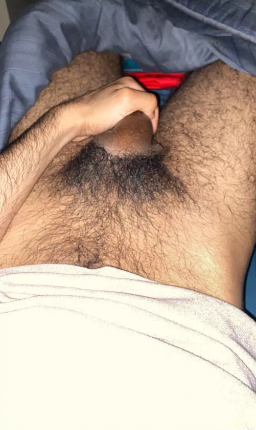 I feel like they’re hairy? 20m by tdaz2072