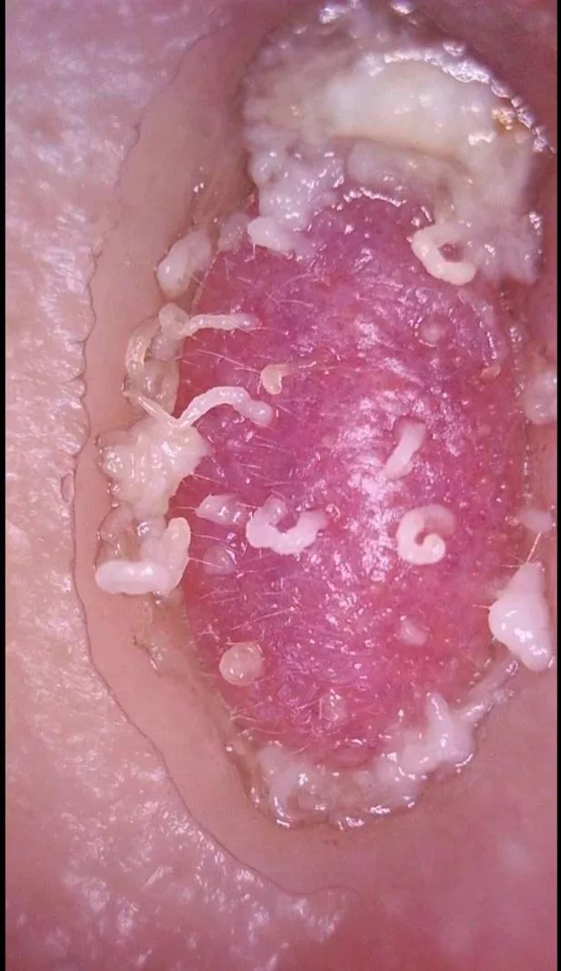 I got a new zit sucker and wanted to share my nose gunk. It wont let me upload the video so this was the next best thing. posted by wombat_hats31