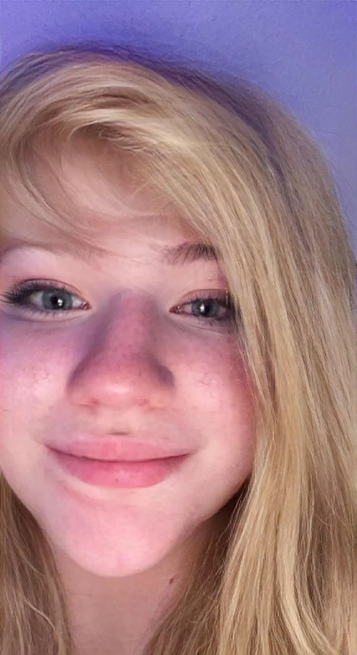 I got pinkeye from giving myself a facial… I think it was worth it posted by TangerineEven1493