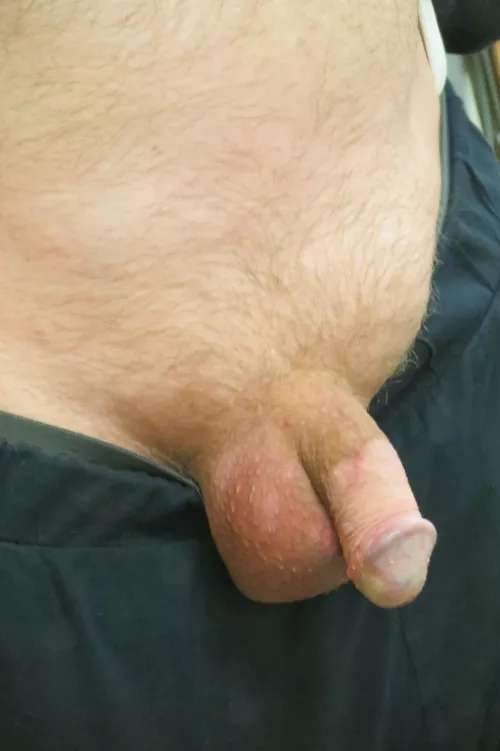 I had shaved my pubes; but luckily, now the ginger glow is back! Grateful! Never shave again! by Sweet-Fortune-8568