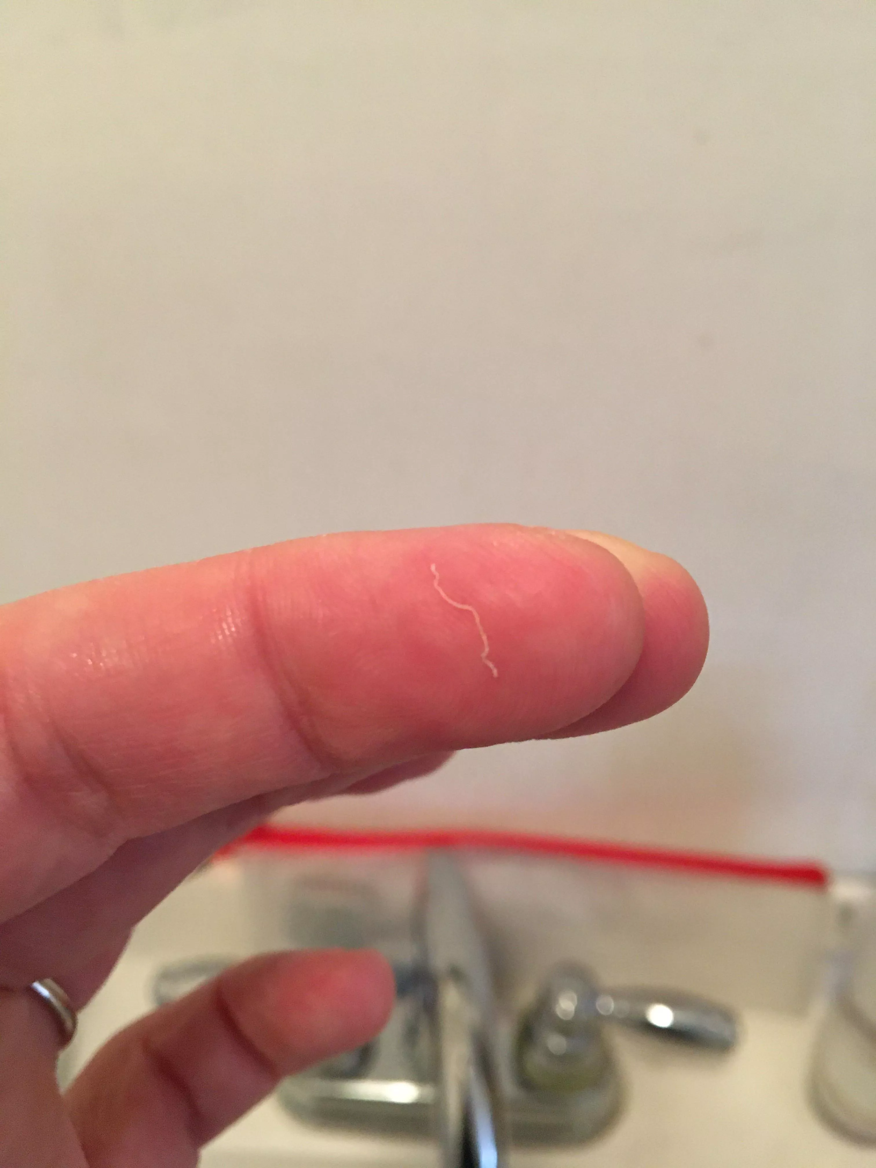 I had the tiniest cyst ever on my jawline and this is what it produced posted by rosssettti