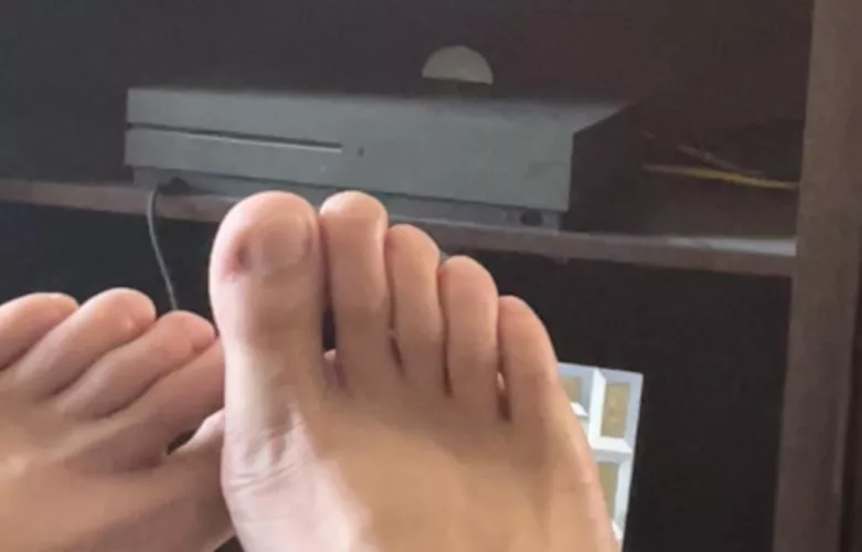 I have cute toes by Harrypotskins1