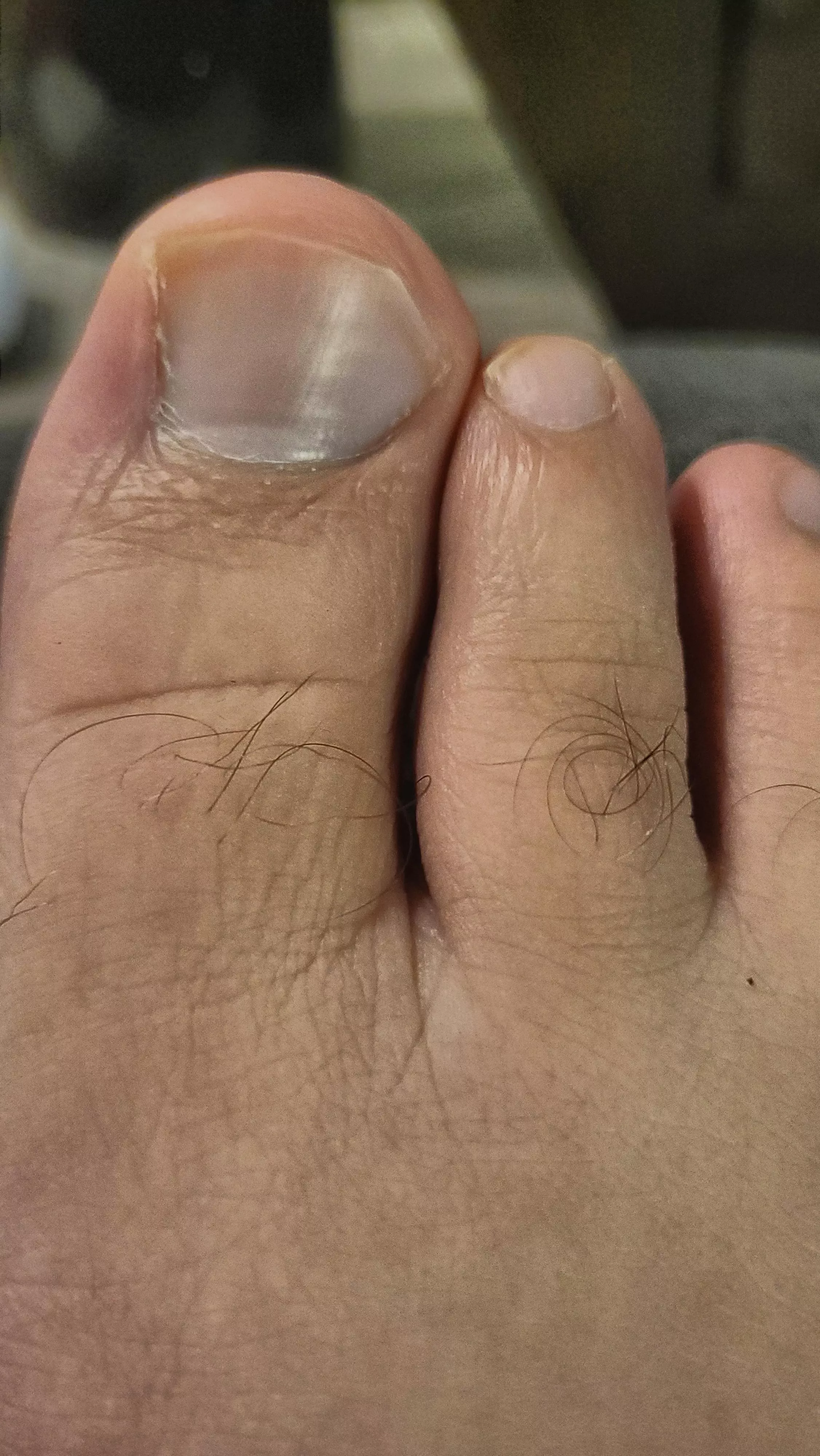 I like looking at my toe hair lol posted by bigfootboy1993