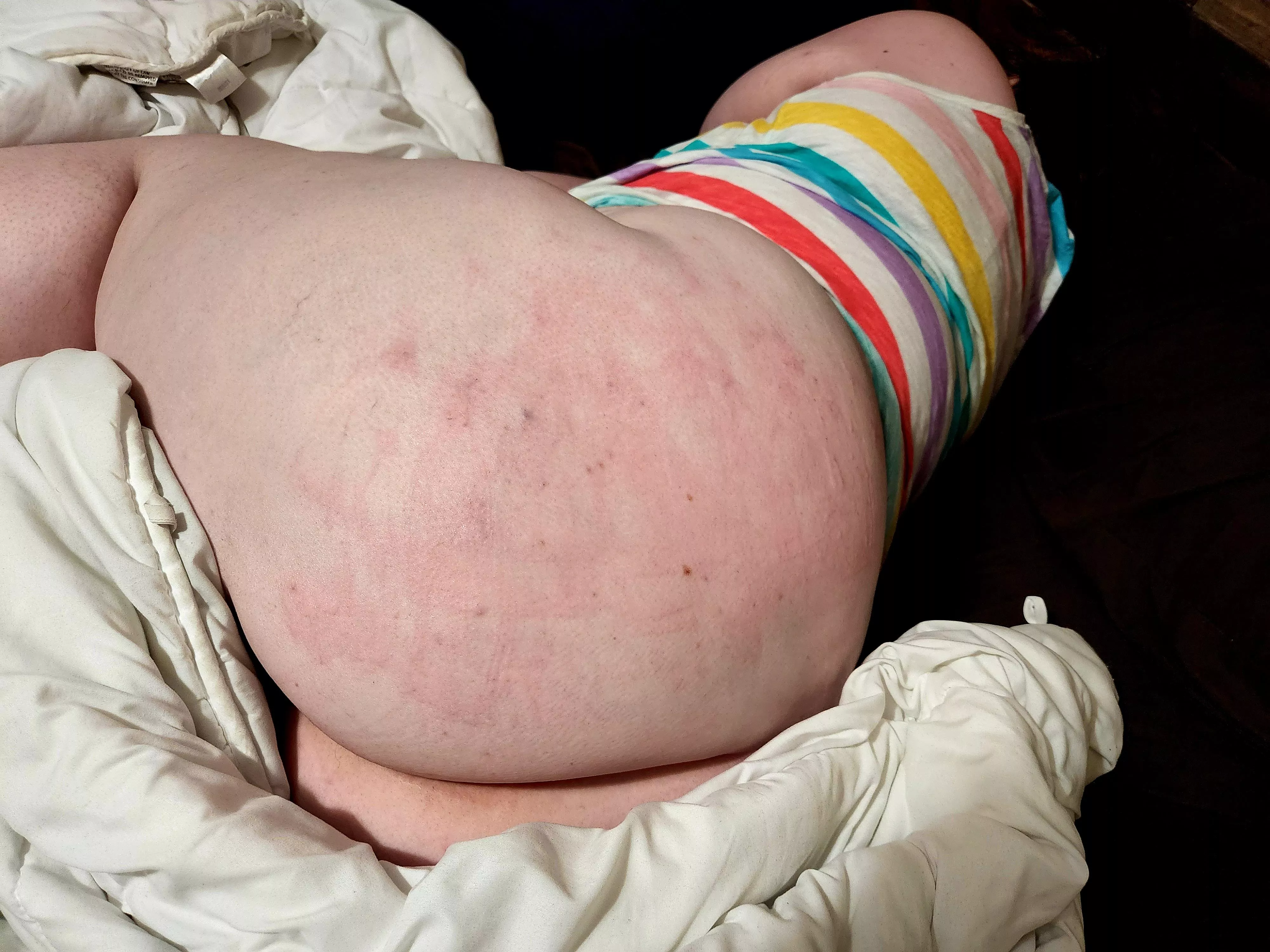 I may have bratted a little too close to the sun.. posted by lifeonshuffle91