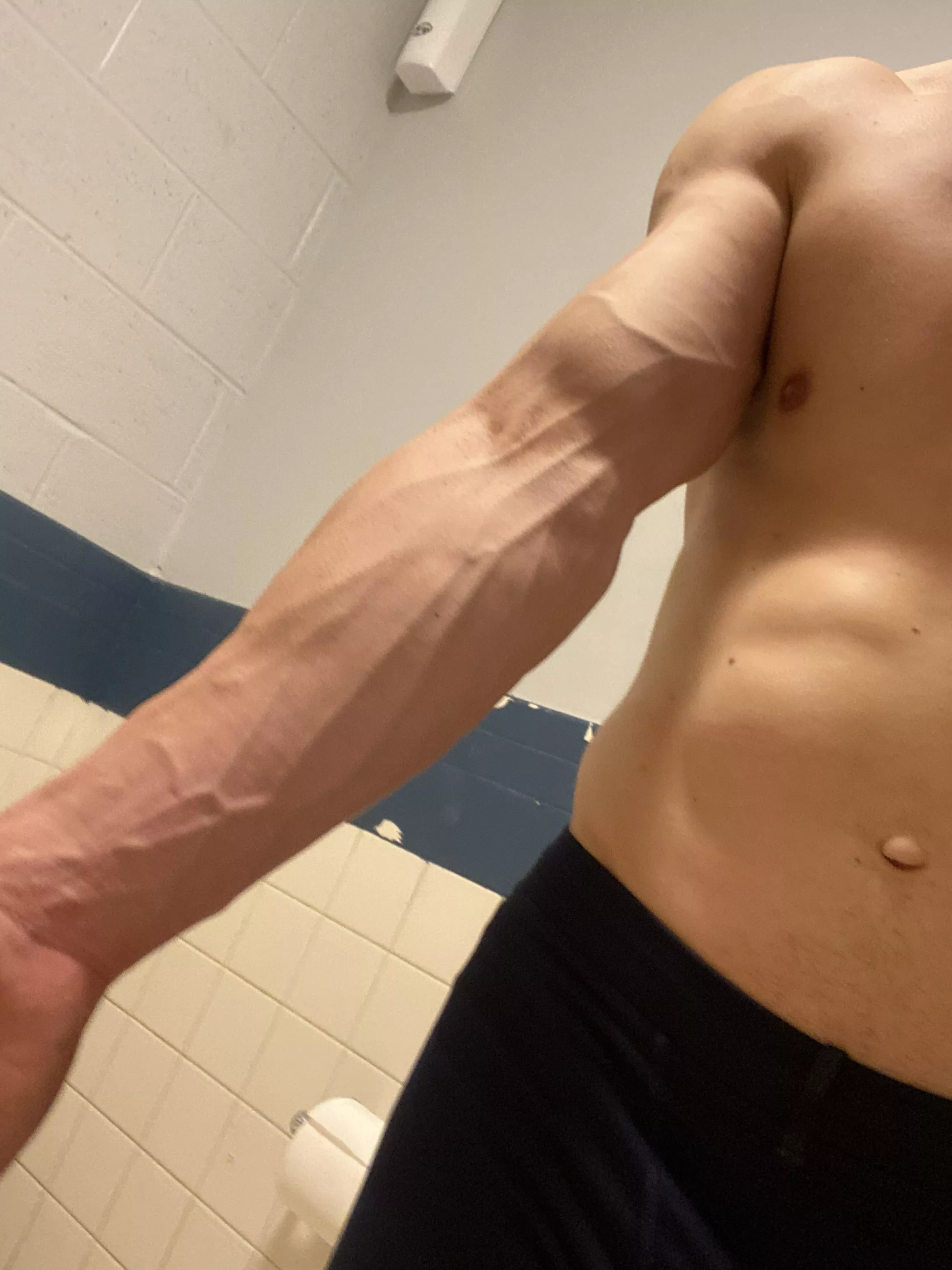 I once donated blood and the nurse missed my vein… How?? posted by Little-Slip-8355