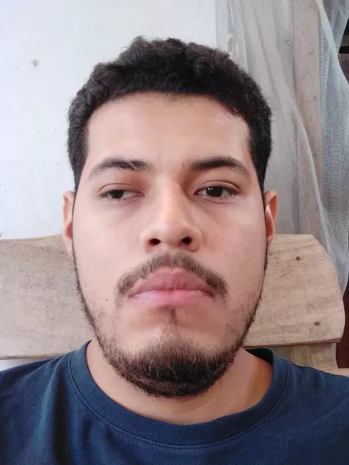 I used to dislike my lazy eye, now I embrace it as something that makes me different. What do you think? by GerardoHD