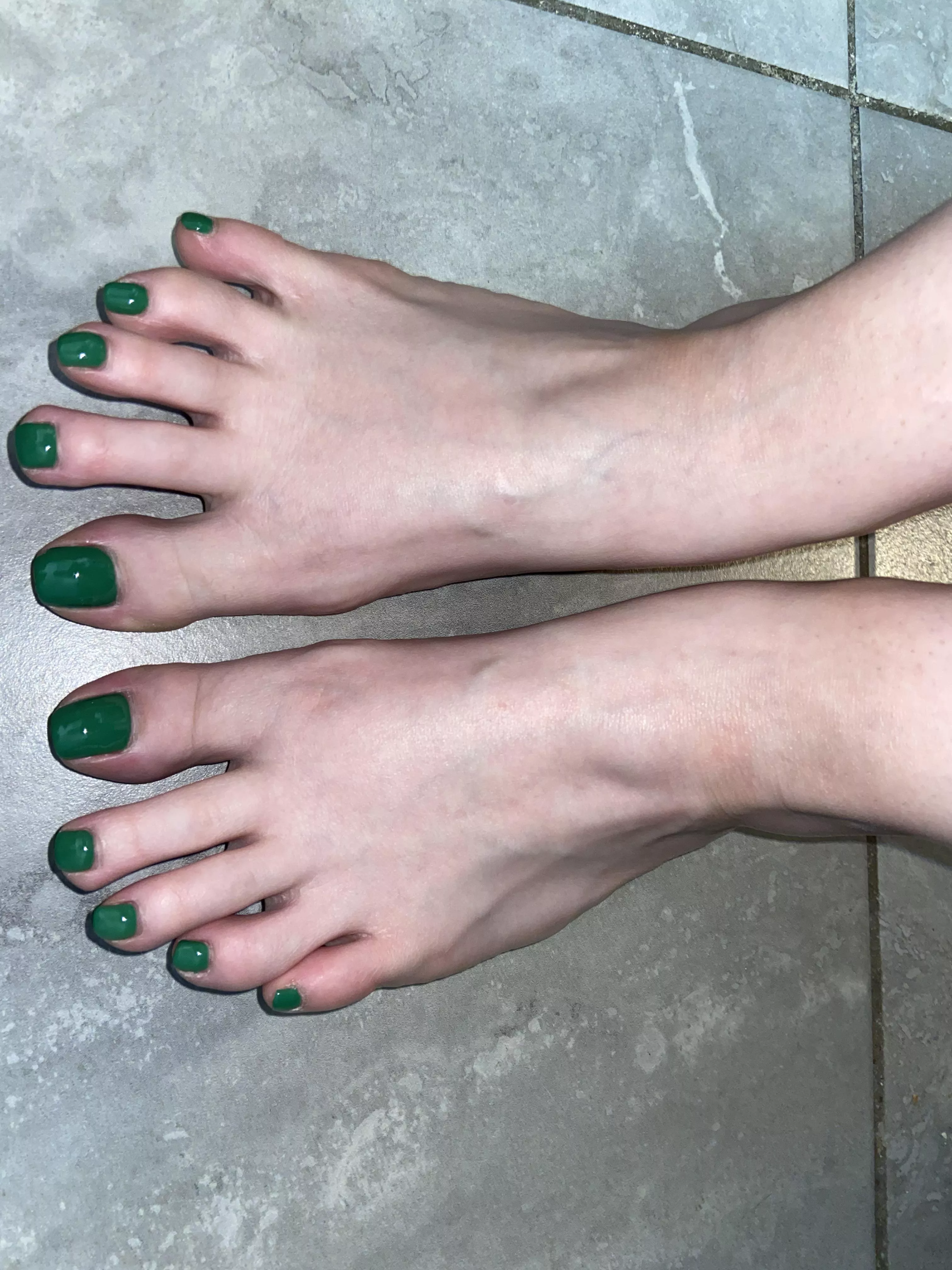 If you saw me walking by barefoot, would you stop and stare? posted by RabbitPaws194