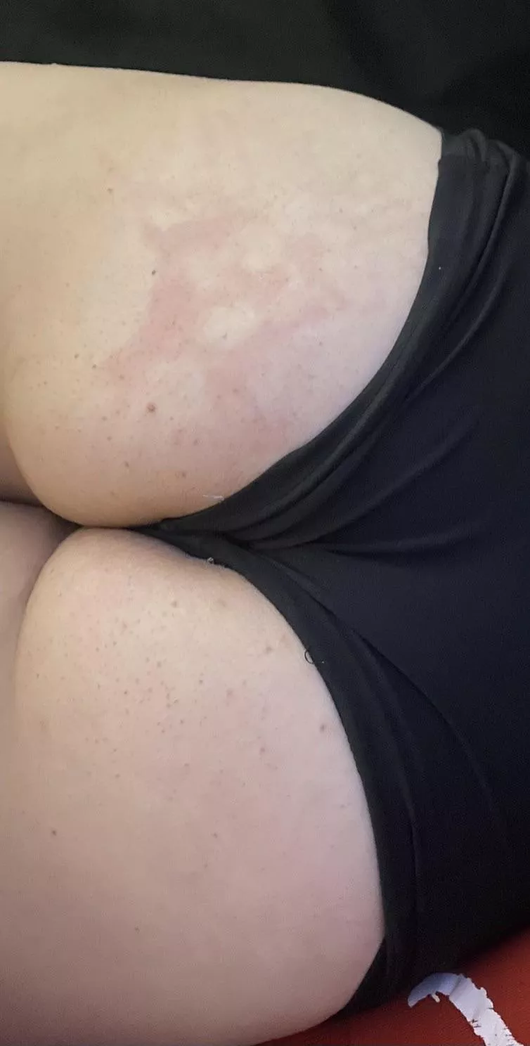 If you see this, you may have a nude posted by Beanie_babyyyyy