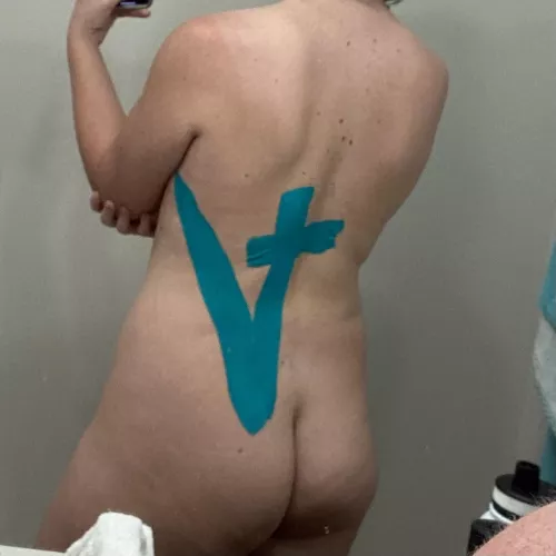 Ignore the KT tape lol 280lbs to 208. 5’11” 21yo female. Lost the 80ish pounds since this time last year. by religiousbirk