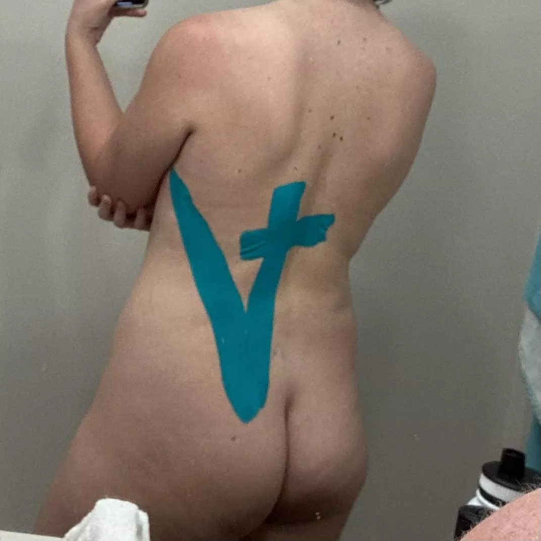 Ignore the KT tape lol 280lbs to 208. 5’11” 21yo female. Lost the 80ish pounds since this time last year. posted by religiousbirk