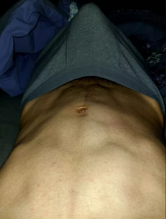 I'm curious how many of you want to take them off 👀 posted by MasterpieceNo6802