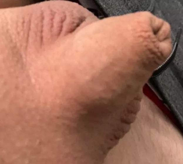 I’m I the only one with horriable shrinkage when cold? posted by AdmirableMuffin9913