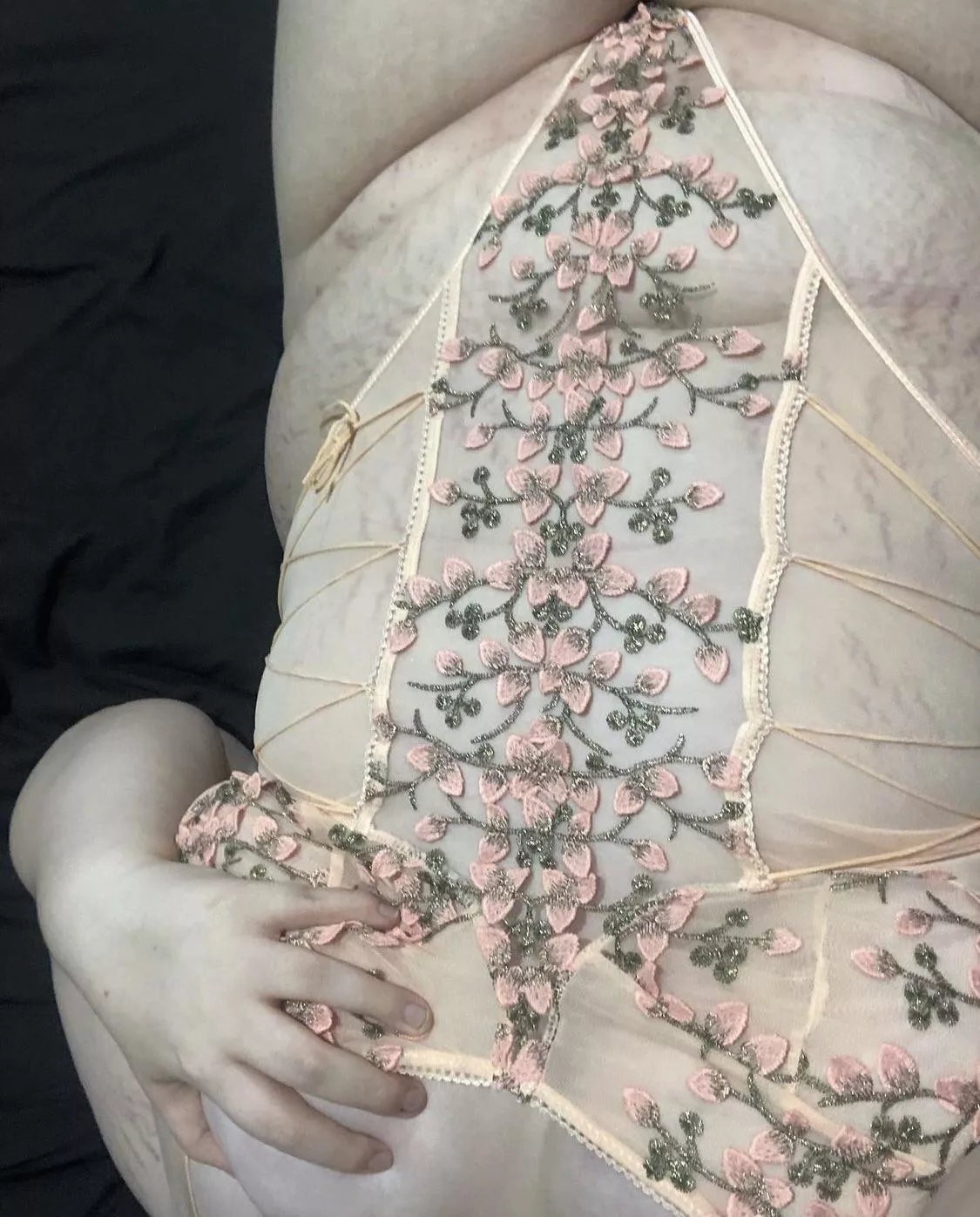 I’m usually self conscious about my stretch marks, but this time they look like lightning or vines. posted by beelzebaybee